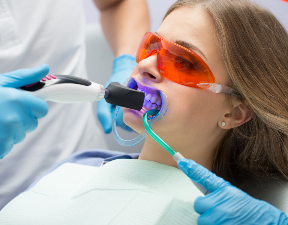 Studi Dentistici Moschioni | Estetica Dentale Sbiancamento Dentale